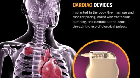 Cardiac Device Design Infographic